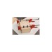 BESSEY Adapter KR-AS für Korpuszwinge(rot, 2 Stück)
